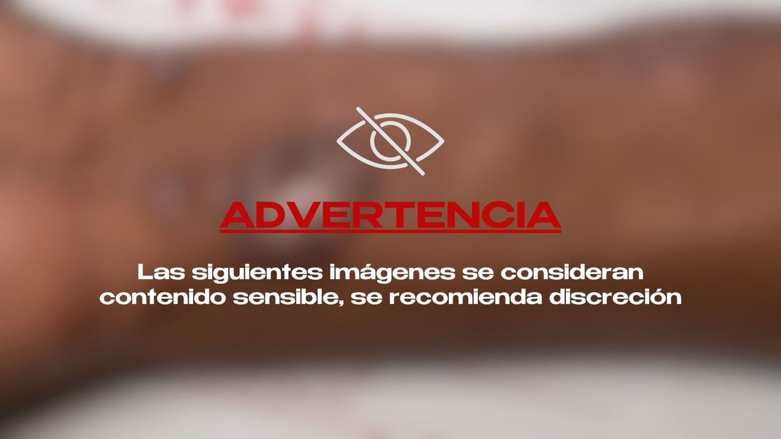 ¡De película a pesadilla! Adolescente se inyectó mercurio para imitar a un superhéroe 